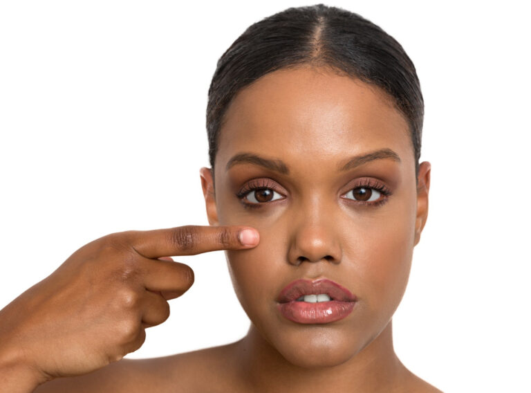 nose-job